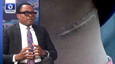 Abuja Kidney Harvesting Scandal: What Does the Law Really Say? | Dateline Abuja
