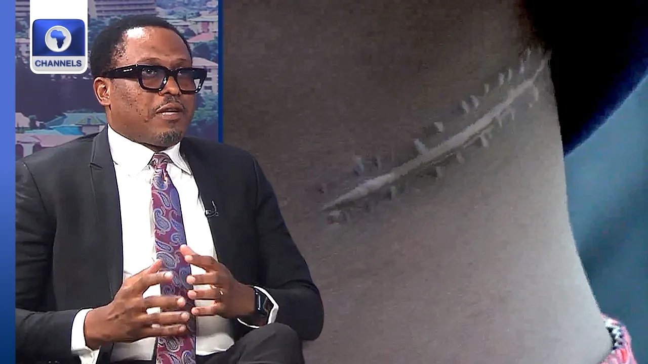 Abuja Kidney Harvesting Scandal: What Does the Law Really Say? | Dateline Abuja