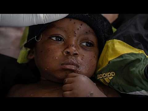 First-ever mpox cases reported in Guinea-Bissau with children the most vulnerable